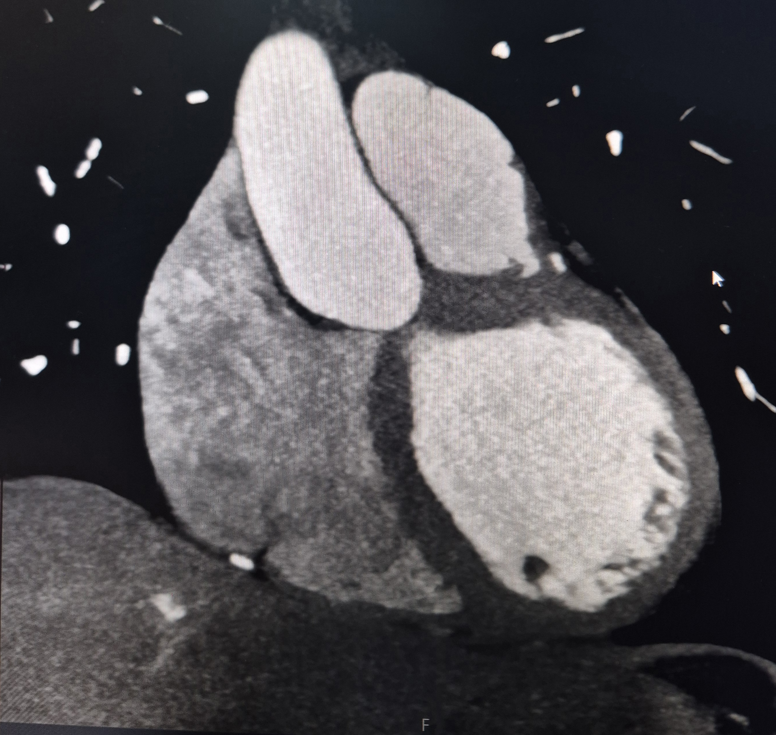 Kardiak ct — şəkil 9